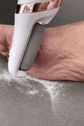 Demonstration animation of electric pedicure foot file removing calluses