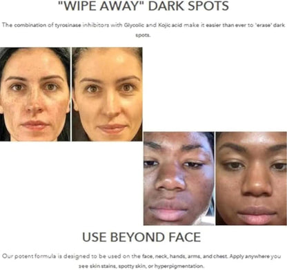 Dark spot lotion for even skin tone