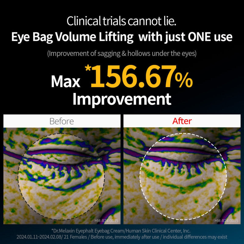 Dr. Melaxin Eyephalt under eye cream for puffiness and fine lines