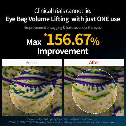Dr. Melaxin Eyephalt under eye cream for puffiness and fine lines