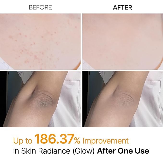 Dr. Melaxin Kojic Acid Peel Shot Spray before and after use