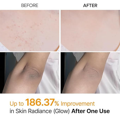 Dr. Melaxin Kojic Acid Peel Shot Spray before and after use