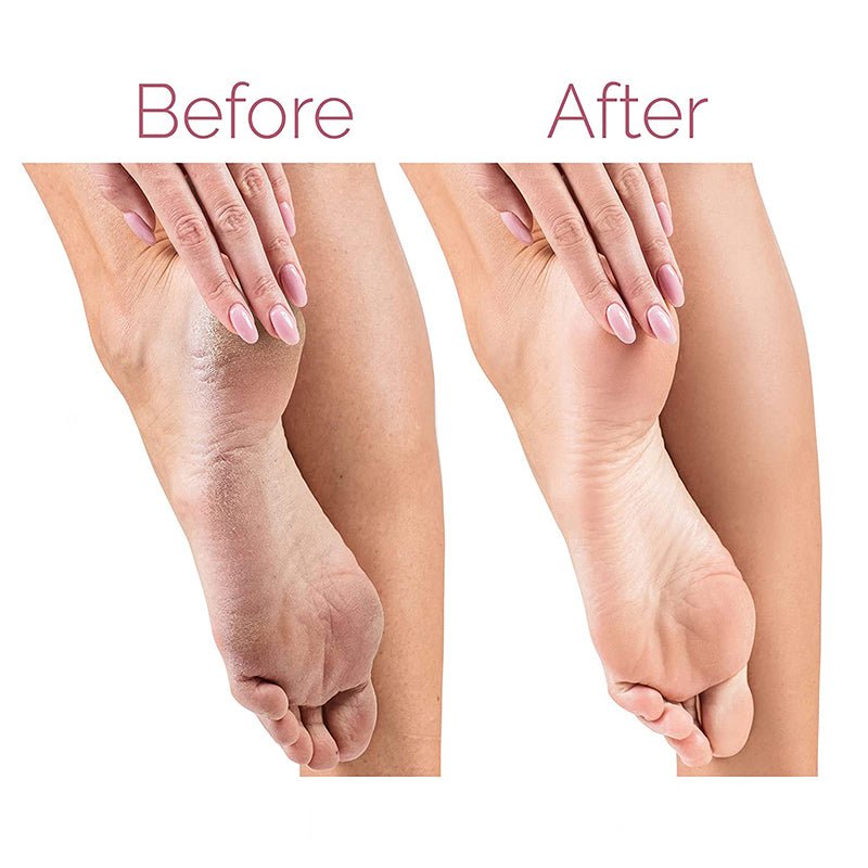 Close-up of dual roller heads on electric pedicure foot file