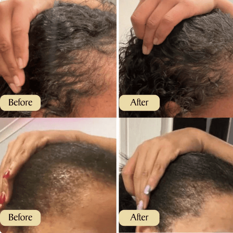 Natural Hair Growth Oil – Rosemary, Castor & Argan Blend 60ml