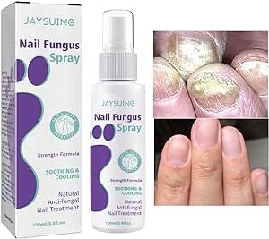 Nail fungus treatment spray packaging and usage instructions