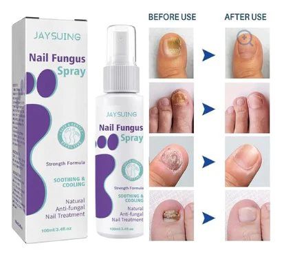 Anti-fungal nail spray bottle close-up