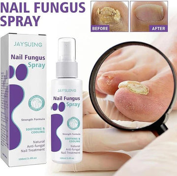 Nail fungus treatment spray application on toenail