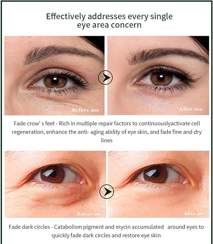 Time Eraser eye essence oil daily eye-care routine